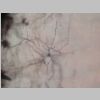 Neuronas Golgi 23.jpg